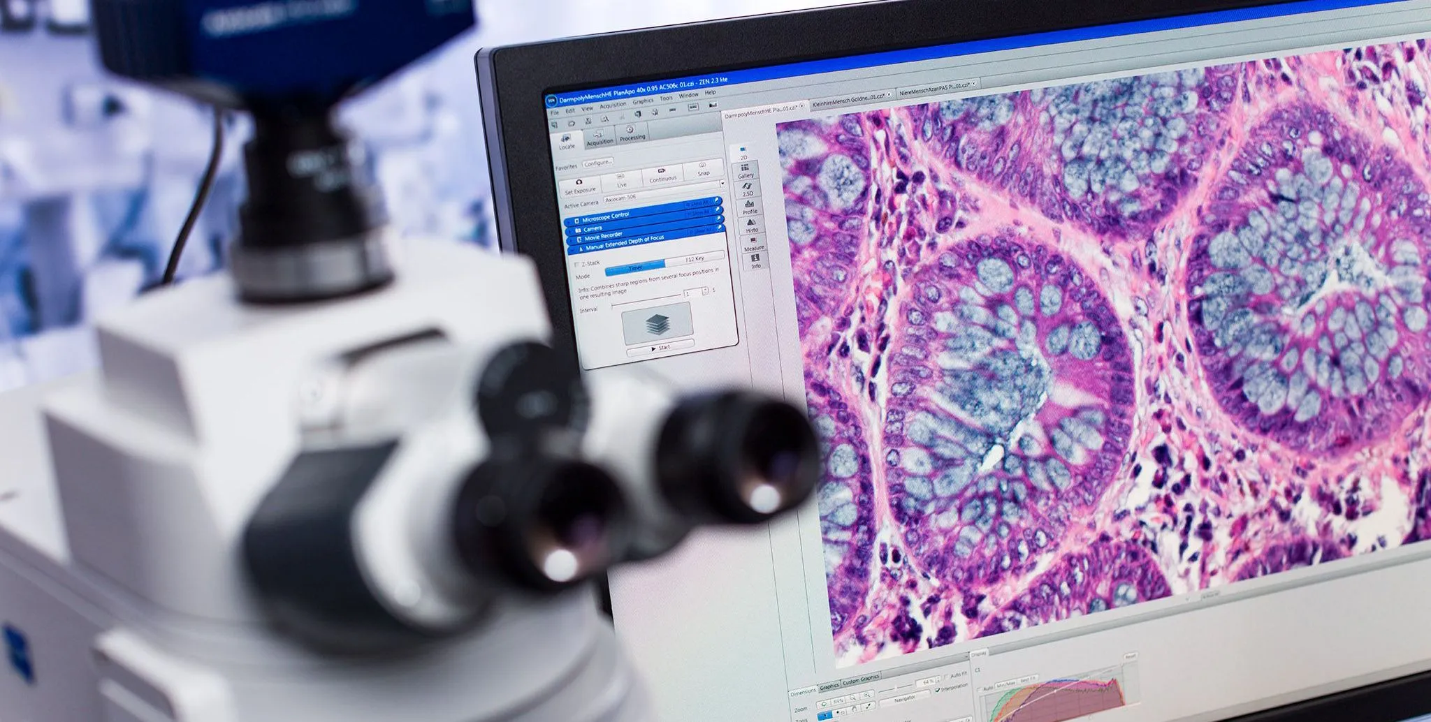 comment-fonctionne-la-camera-d-un-microscope-numerique-11-05-2026-e08-5-001477-1