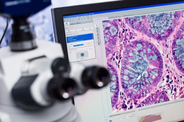 Comment Fonctionne la Caméra dun Microscope Numérique ?